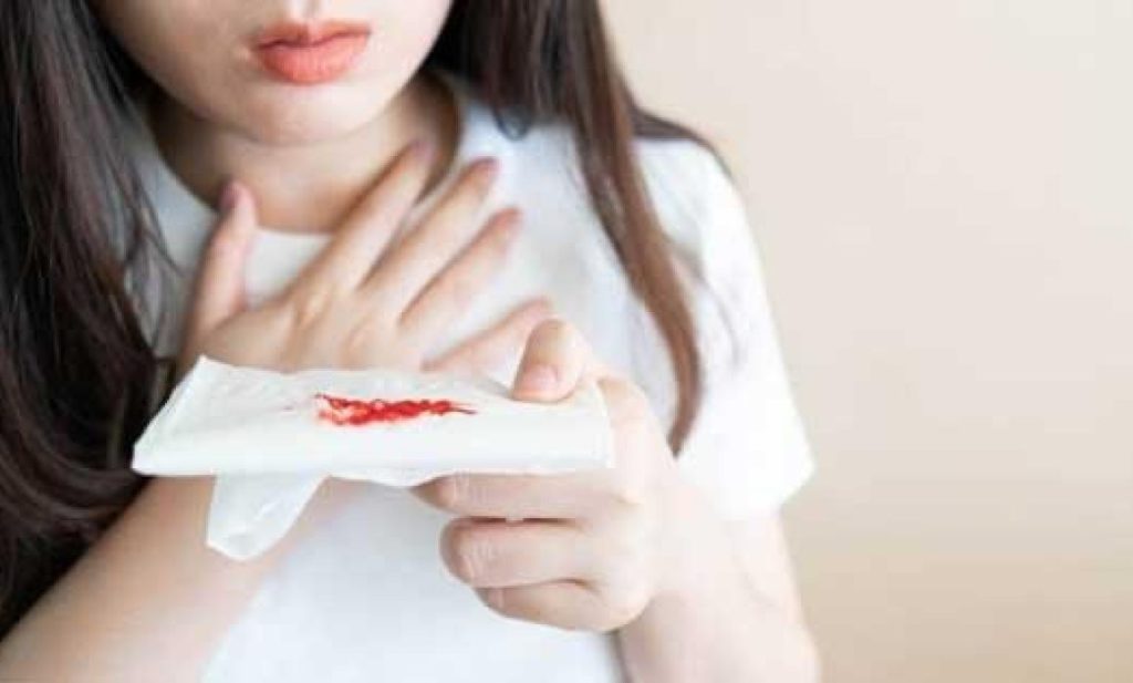 #Veracruz Advierte IMSS sobre tuberculosis&nbsp;pulmonar